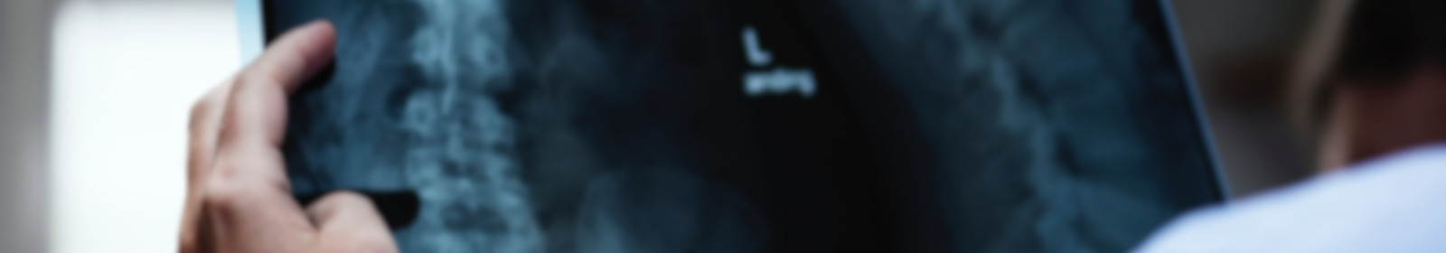 A physician examines an x-ray